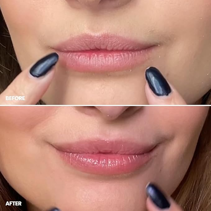 Wonderskin Lip Scrub - 3-in-1 Exfoliator & Moisturizer, Lip Exfoliator Scrub, Hydrating Balm for Soft, Nourished, Flake-Free Lips with One-Step Prep, 0.10oz