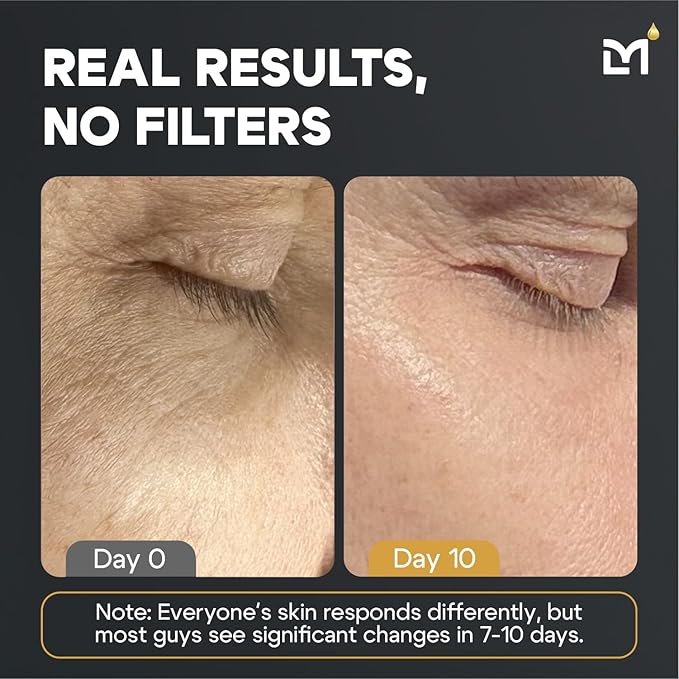 Titan Peptide 4-Piece Anti-Aging Mens Skin Care Kit – Wash, Face Serum, Eye Cream, Mens Face Moisturizer – Skin Care for Men – Dark Circles, Wrinkles, Fine Lines – Vitamin C, Niacinamide, HA