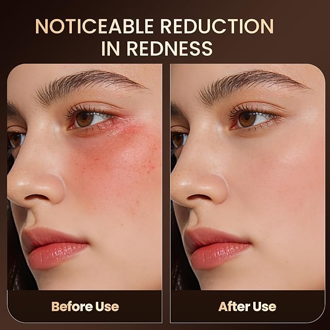 Red Light Therapy Mask for Face, Led Face Mask Light Therapy with 2000mAh Rechargeable Remote, LED Face Mask for Radiant Glow at Home, Black