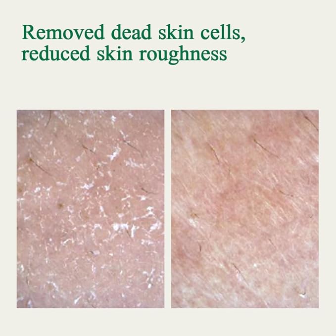 Pyunkang Yul PKY Ultimate Calming Solution Cream for Sensitive Skin with Patented Ingredients, Moisturizer Intensely Calms & Soothes Redness with Cica & Tea Tree, Korean Skincare (1.01 Fl. Oz, 30ml)