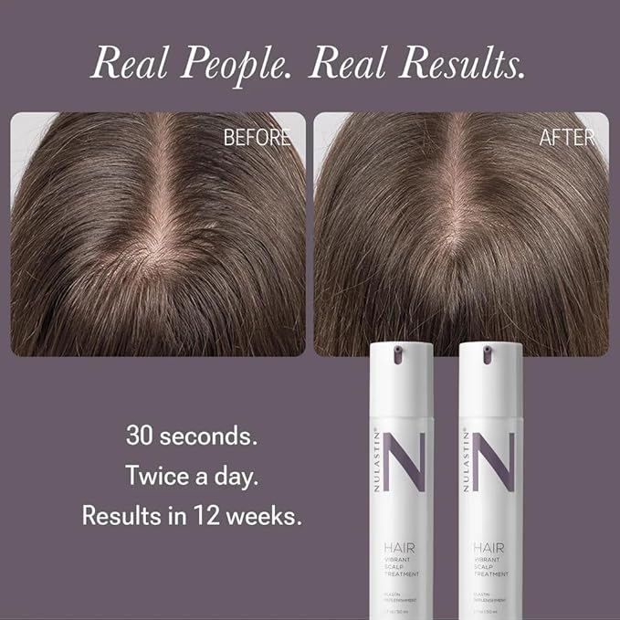 NULASTIN Solution Serum System - Lash Serum (0.1 Fl Oz), Scalp Treatment (1.7 Oz) + Brow Serum (0.1 Fl Oz) - Travel Gift Set for Fuller Lashes, Thicker Hair & Defined Brows (3 Count)