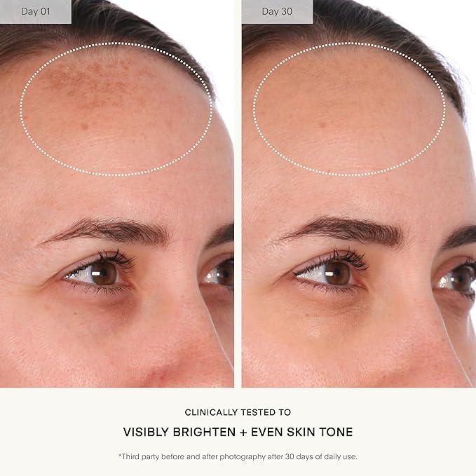 U Beauty Resurfacing Compound - Anti-Aging Daily Serum with Mandelic Acid, a Gentle Blend of Exfoliants, Retinol + Vitamin C for Smoother, Brighter, & Revitalized-Looking Skin - 1.7 fl oz