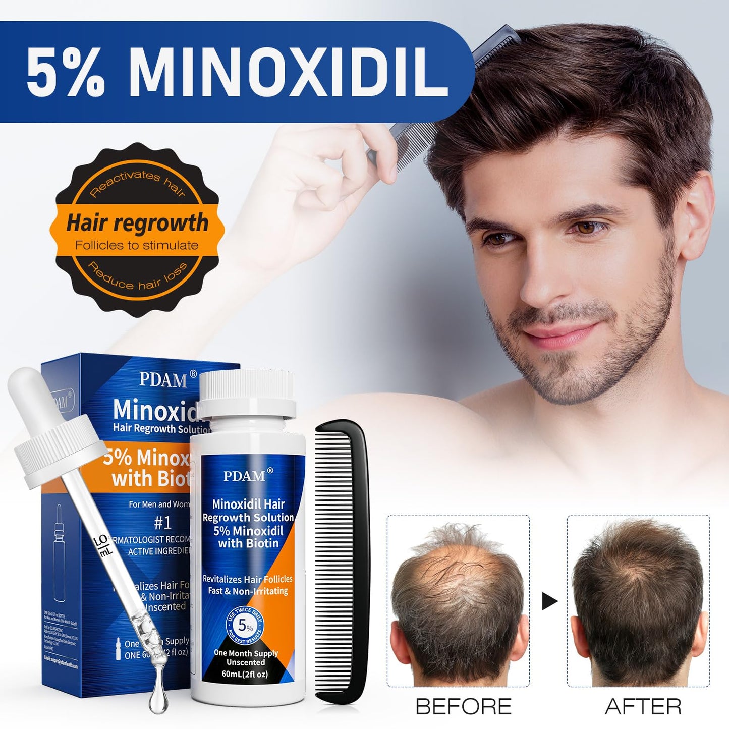 5% Minoxidil for Men Hair & Beard Growth Kit, Minoxidil for Women Hair Growth Serum, Extra Strength Hair Loss Treatment for Thinning Hair, Promotes Thicker Fuller Regrowth, Nourishes Scalp, 2 × 2oz