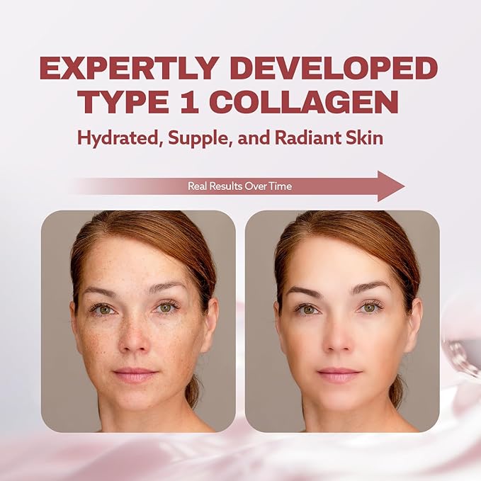 ILO Type 1 Liquid Collagen Drink – 3,000mg Marine Collagen with Biotin & Ceramide | Skin Glow & Hydration | Orange Flavor | 14 Bottles – Korean Beauty Supplement
