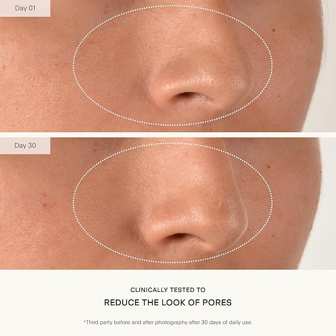 U Beauty Resurfacing Compound - Anti-Aging Daily Serum with Mandelic Acid, a Gentle Blend of Exfoliants, Retinol + Vitamin C for Smoother, Brighter, & Revitalized-Looking Skin - 1.7 fl oz