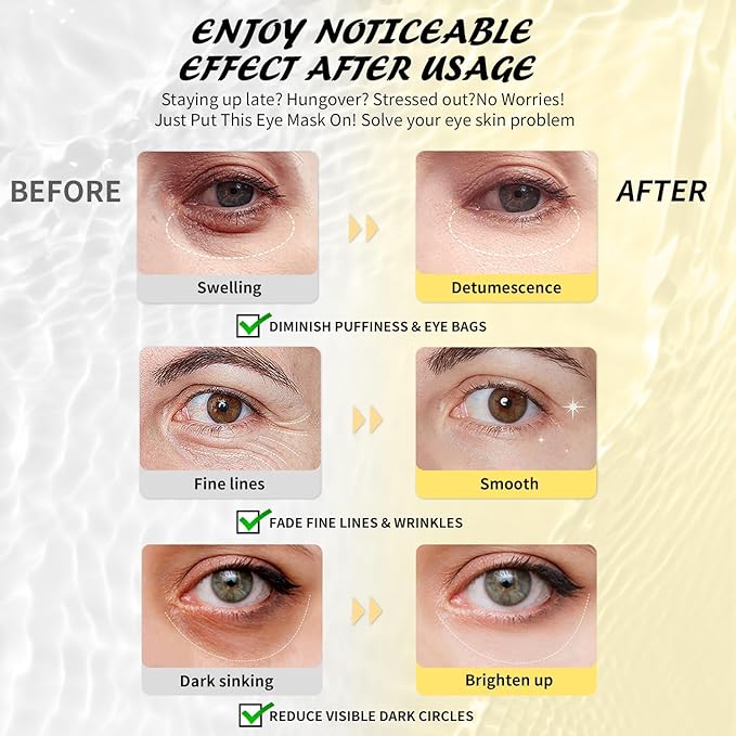 Under Eye Patches Variety Pack (48 Pairs), Valentine‘s Day Gifts for Her, Eye Masks for Dark Circles Puffy Eyes With 8 Colors (6 Pairs/Color), Vegan Skin Care Gifts for Women