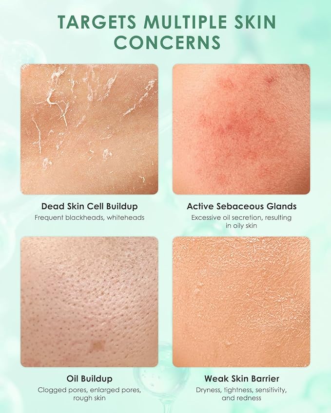 Rare Ginsenoside Oil Control And Purifying Clay Mask,Deeply Clean Pores,Soothe & Repair,Blackhead Removal,Exfoliation,For Oily,Combination & Acne-Prone Skin,10 Single-Use Boxes