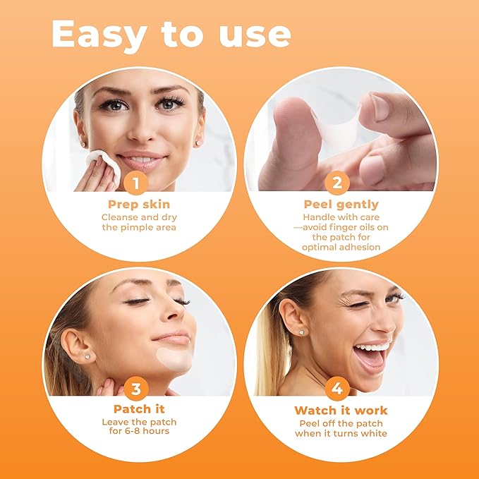 Chin Pimple Patches (12 Pack), Chin Acne with Large Hydrocolloid Acne Patches For Blemishes on Chin, Cheek, Forehead