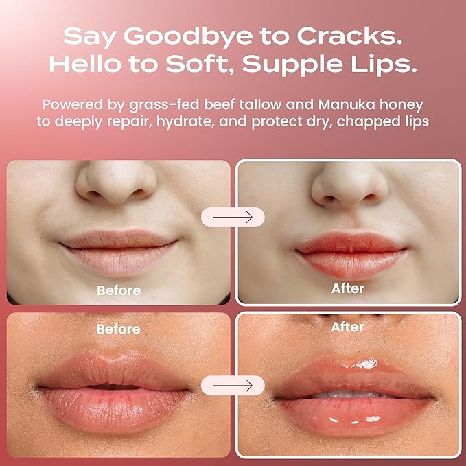 Body Restore Grass Fed Beef Tallow Lip Mask, Manuka Honey – Valentines Day Gifts for Her and Him, Hydrating Moisture, Travel Essentials, Self Care, Birthday Gifts for Women and Men – Unscented