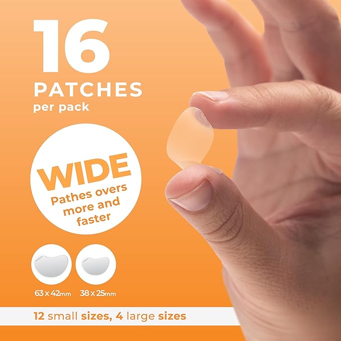 Chin Pimple Patches (12 Pack), Chin Acne with Large Hydrocolloid Acne Patches For Blemishes on Chin, Cheek, Forehead