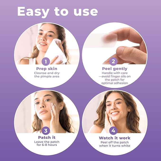 Large Pimple Patches for Face (20 Pack), Hydrocolloid Acne Patch, Hydrocolloid Bandages, Big Pimple Patches, Large Acne Patch