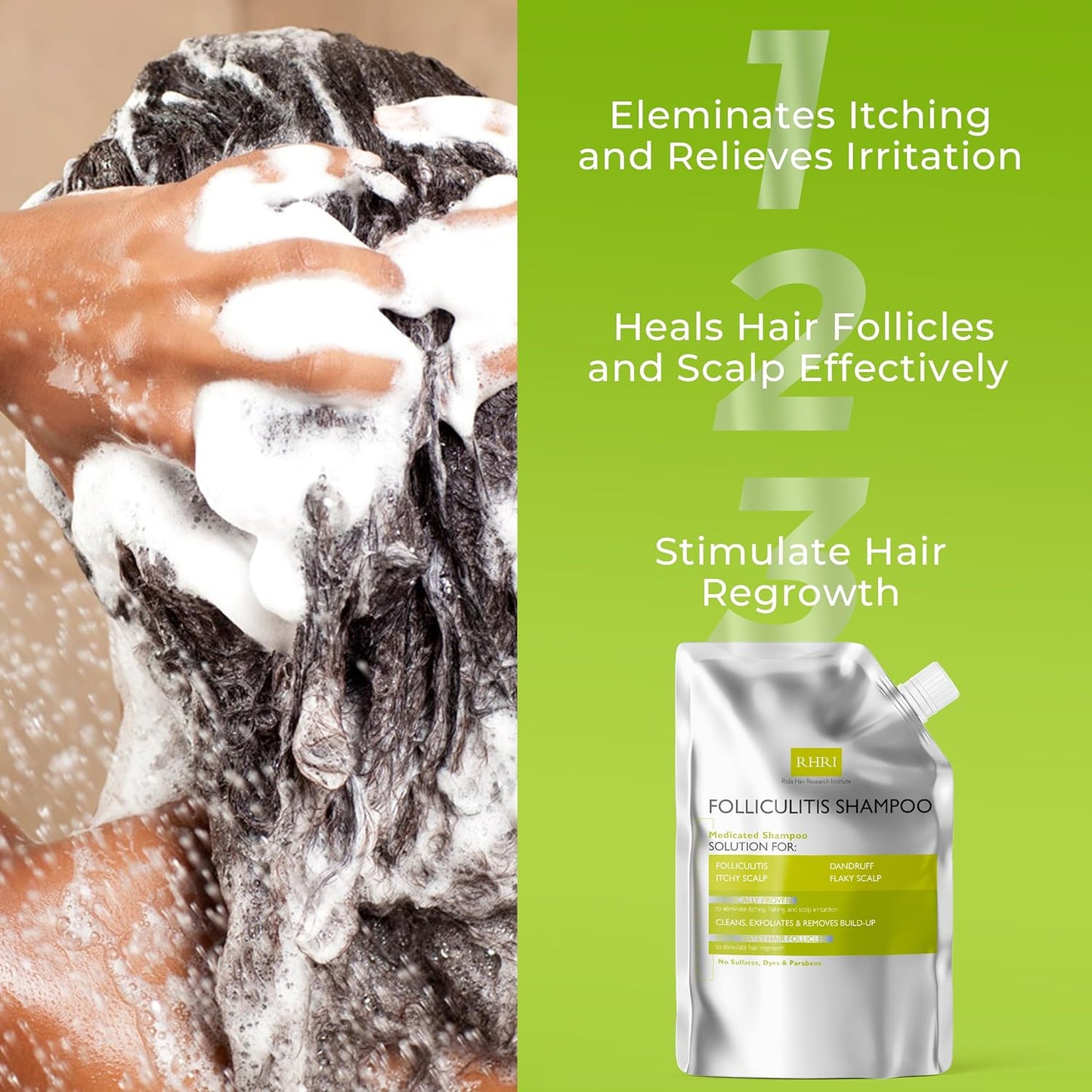 Anti Fungal Shampoo for Folliculitis, Seborrheic Dermatitis, Dandruff, Scalp Psoriasis & Itchy Dry Scalp Relief