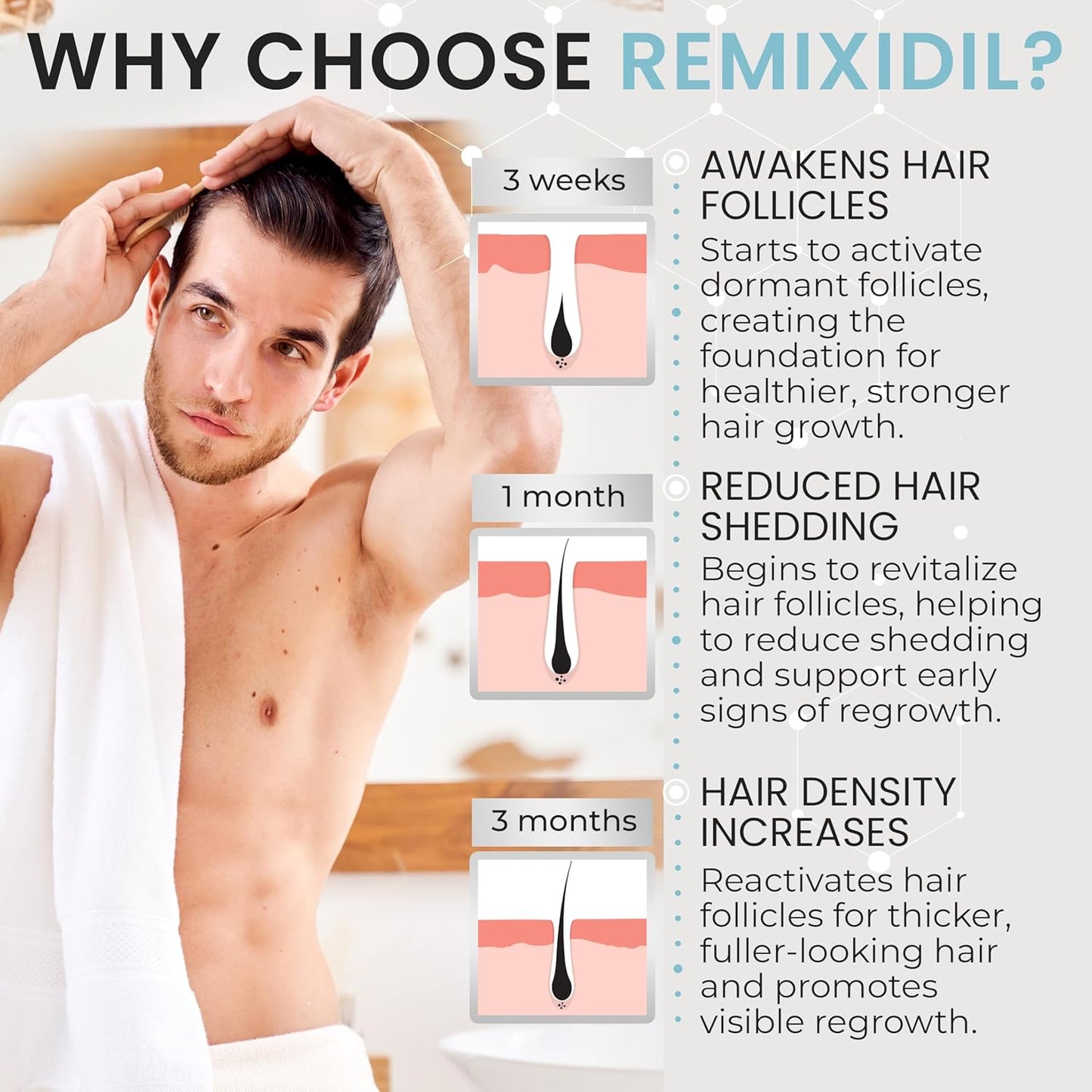 Remixidil Men’s 5% Minoxidil Foam | Hair Regrowth Treatment for Men | Clinically Proven Formula for Hair Loss and Hair Growth | No Scalp Irritation | 3-Month Supply