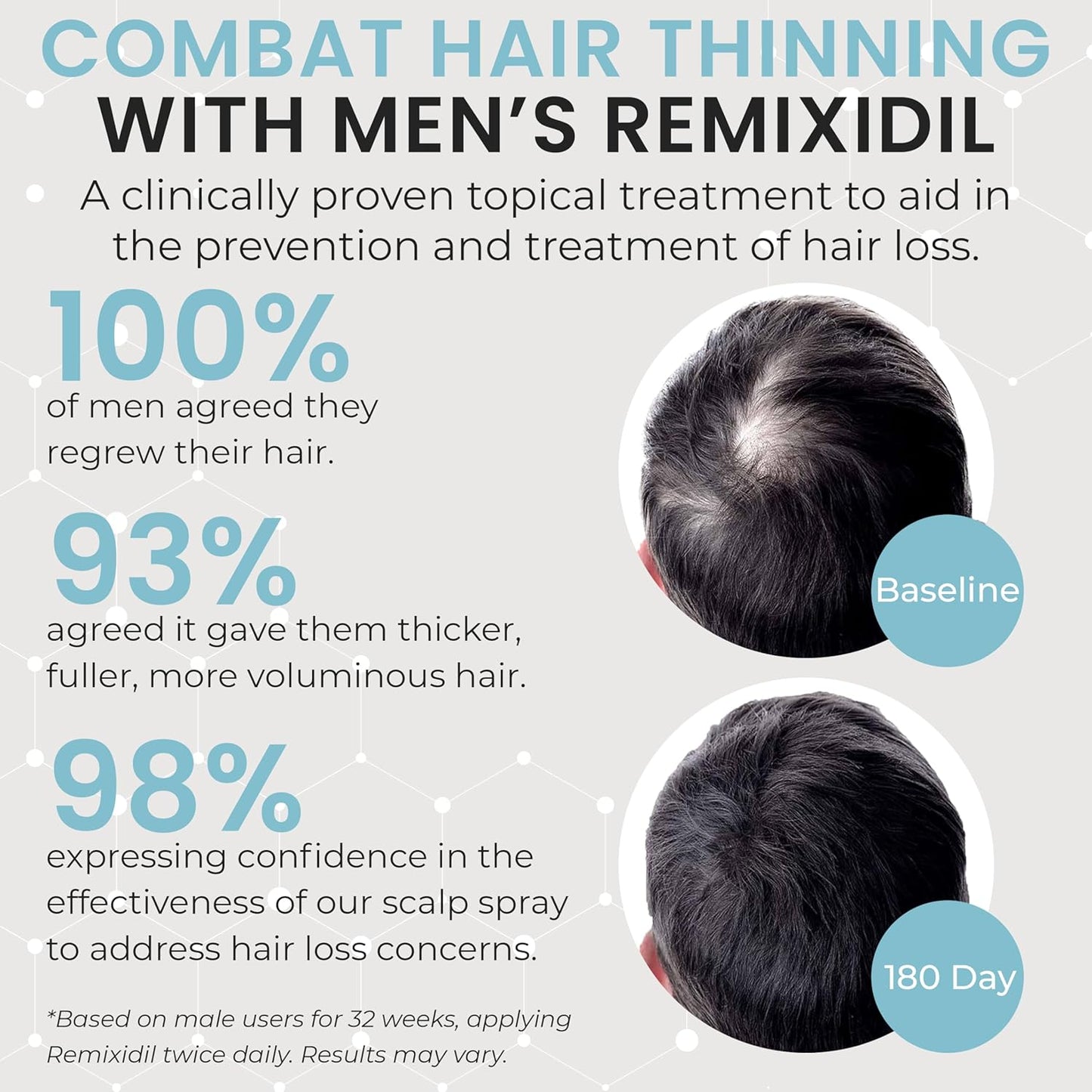 Minoxidil for Men | 5% Minoxidil Hair Regrowth Treatment | Unscented, Clinically Proven for Thinning Hair Regrowth & Follicle Reactivation | Hair Loss Treatments For Men- 60 ml