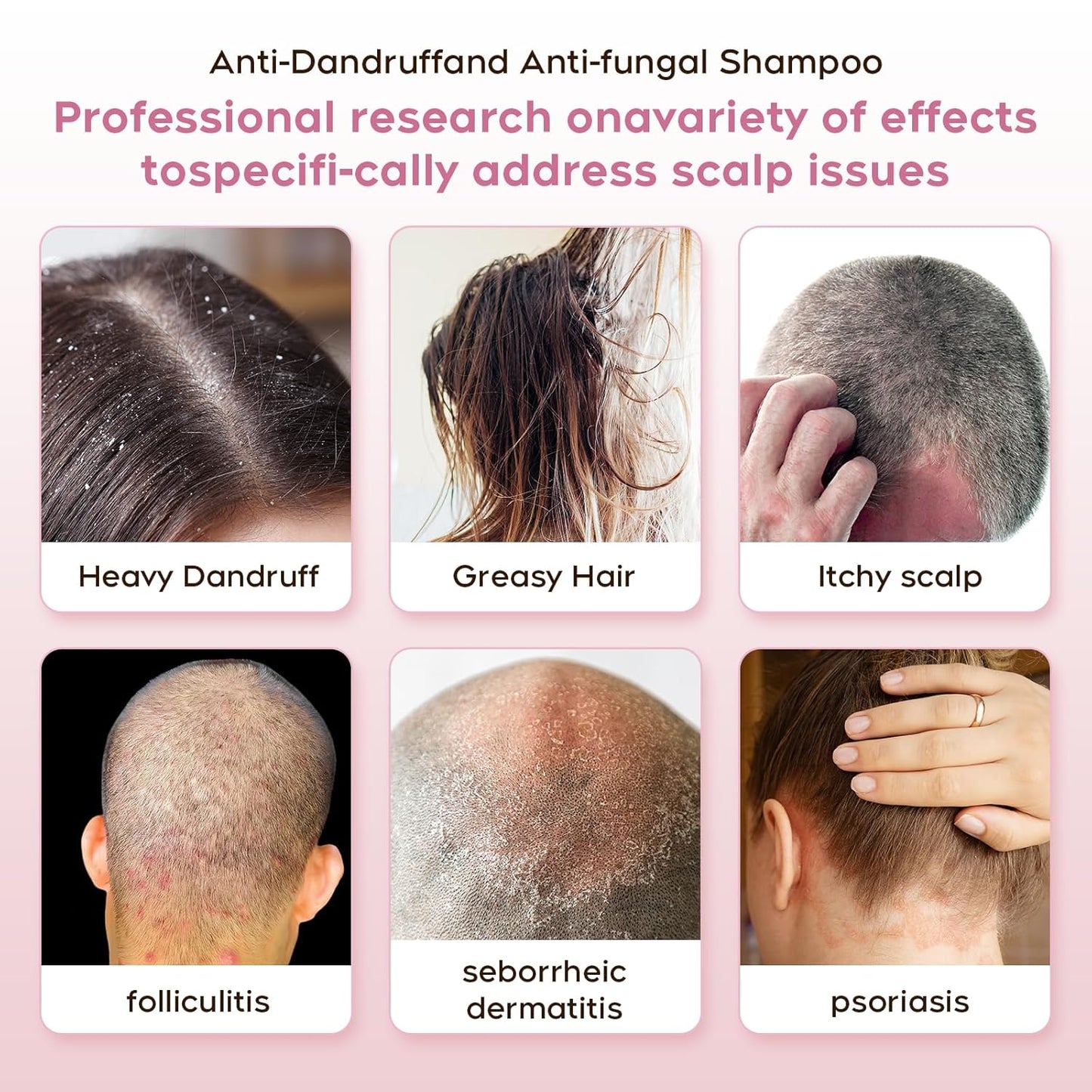 24HR Fast Itch Relief Anti-Fungal Shampoo for Psoriasis, Seborrheic Dermatitis & Folliculitis, Relieves Itchy, Dry Scalp, Sulfate & Paraben Free Anti-Dandruff Shampoo for Men and Women, 8.4 fl oz