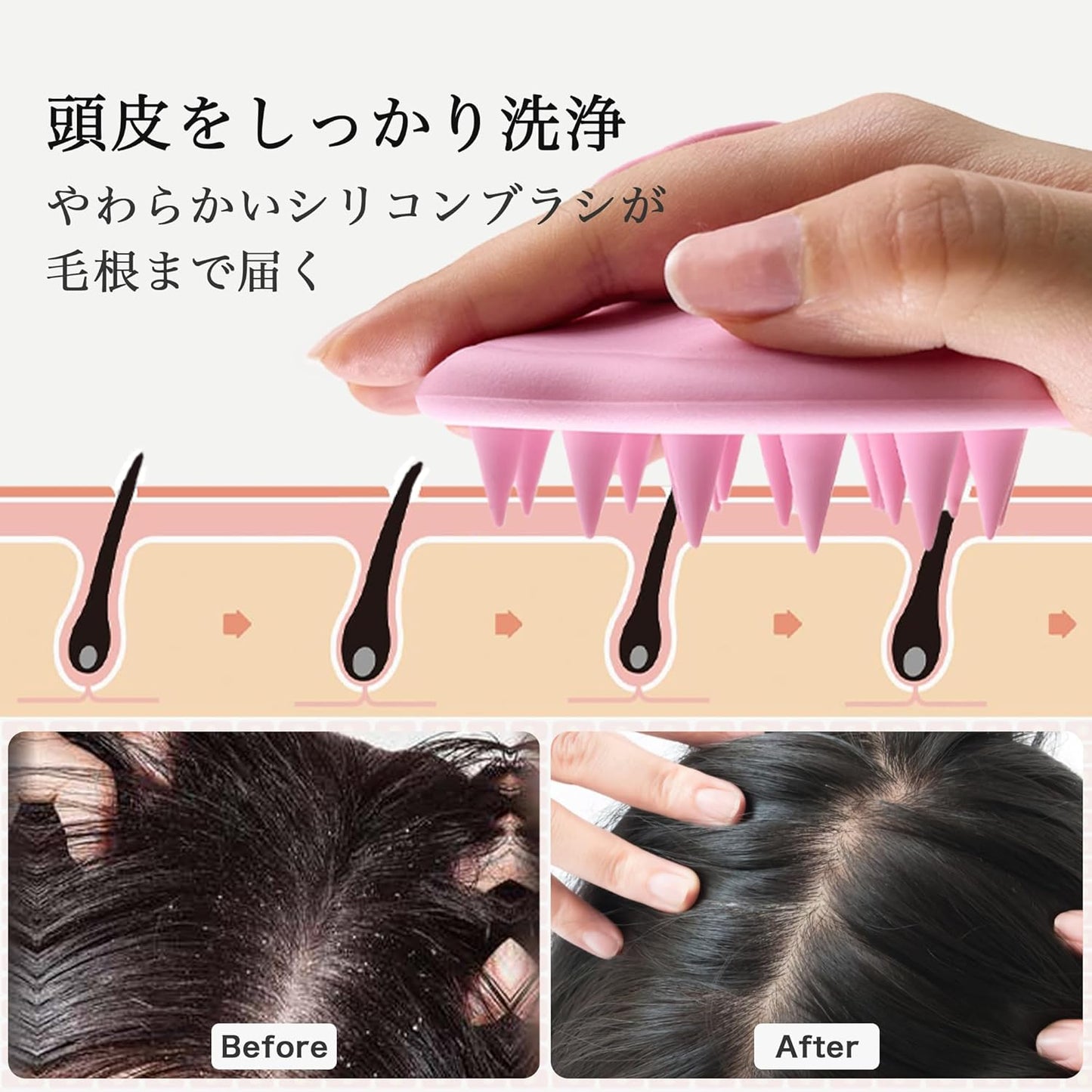 Halocalm Scalp Massager for Hair Growth – Silicone Shampoo Brush for Wet & Dry Hair, Integrated Design, Effective Scalp Scrubber for Shower & Relaxation (Pink)