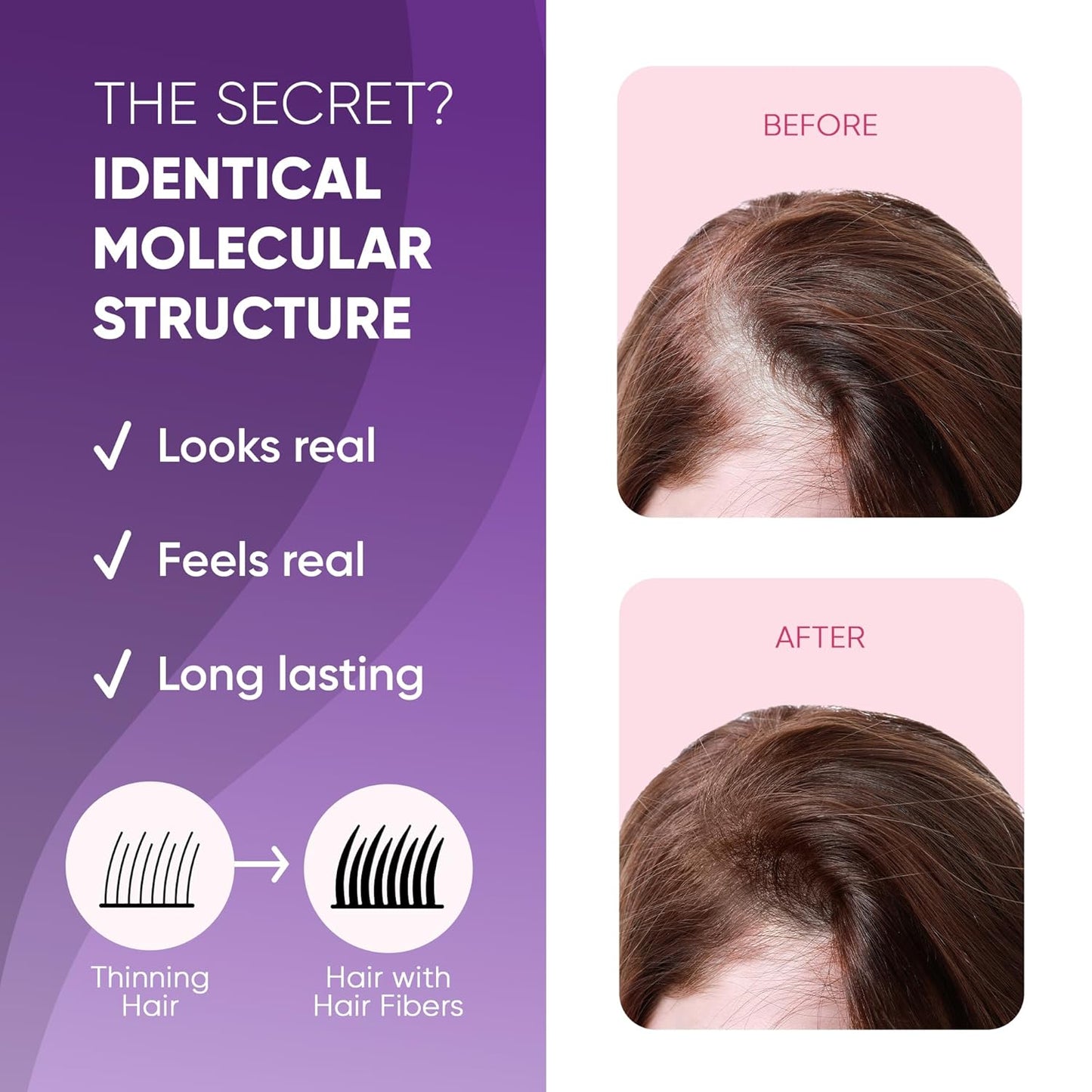 GBG Hair Fibers for Thinning Hair & Bald Spots (Black) - 25g Bottle - Conceals Hair Loss - Instant Cover Up & Volume in 30 Seconds, Hair Powder for Women & Men - Cruelty Free