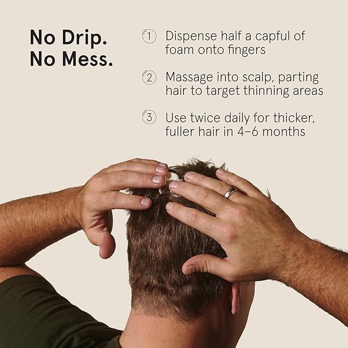 Keeps Extra Strength Minoxidil for Men Topical Aerosol Foam 5%, Hair Growth Treatment - 3 Month Supply (3 x 2.11oz Bottles) - Thicker, Longer Hair - Slows Hair Loss & Promotes Hair Regrowth