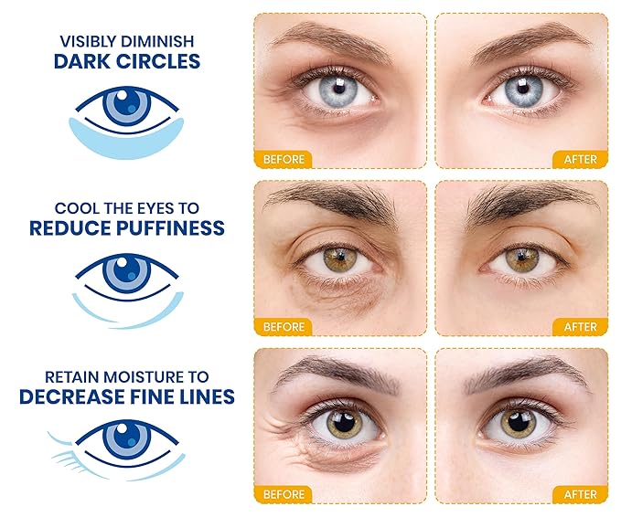 Stylia Under Eye Patches for Puffy Eyes and Dark Circles (20 Pairs) - 24k Gold Under Eye Mask with Vitamin C, Hyaluronic Acid, Pearl Extract - Eye Masks for Dark Circles and Puffiness